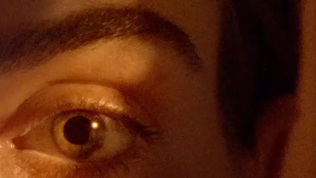 Skin Type Image