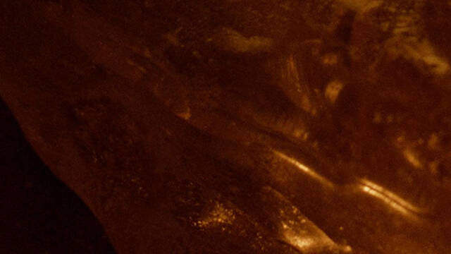 Skin Type Image